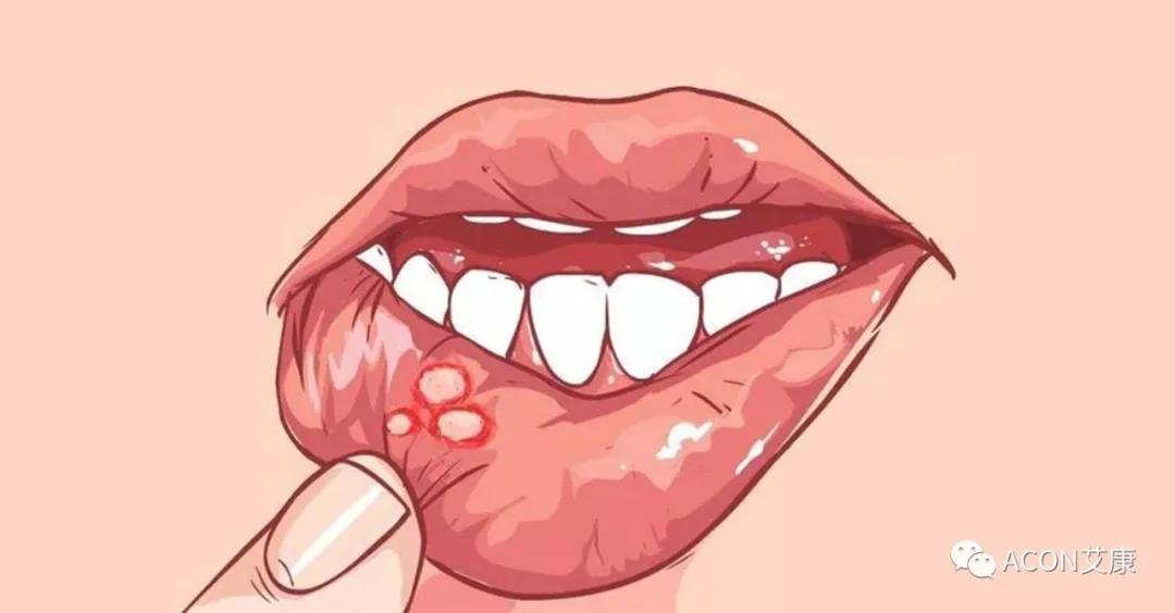 哪些小病容易讓人忽視，最后造成越拖越嚴(yán)重呢？