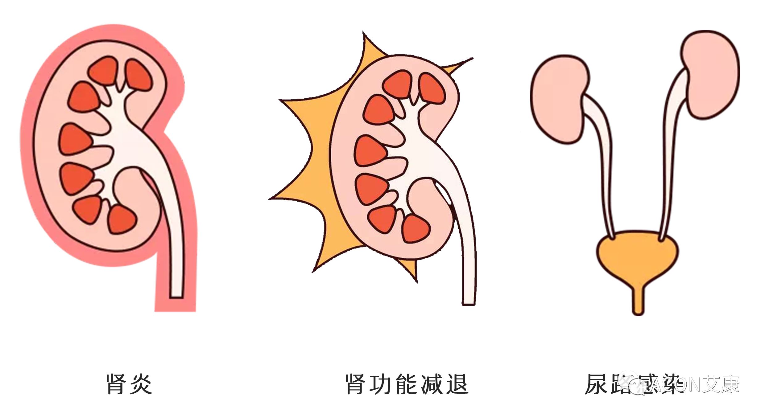 排尿黃、異味大，可能是身體在報警！