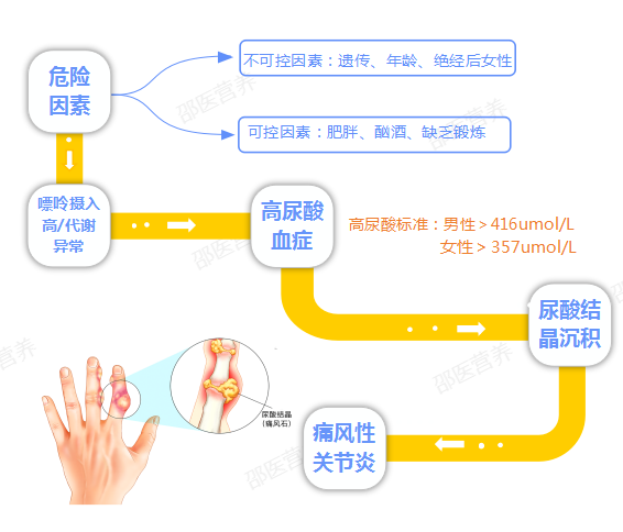 痛風(fēng)為什么偏愛男性？你最關(guān)心的問題都在這里