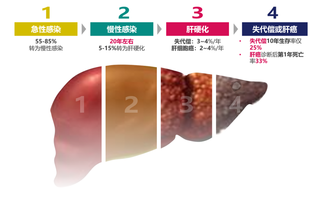 悄悄變成肝硬化、肝癌，很多人感染了卻不知道