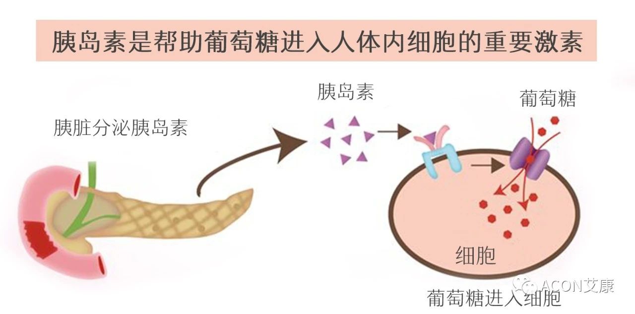 爆上熱搜，因爆發(fā)型糖尿病進入ICU，有哪些教訓值得我們汲取