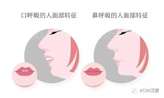過(guò)敏性鼻炎會(huì)讓孩子變傻？！家長(zhǎng)該如何應(yīng)對(duì)